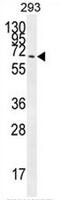 Cilia And Flagella Associated Protein 100 antibody, AP50776PU-N, Origene, Western Blot image 