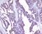 Sorcin antibody, A00222, Boster Biological Technology, Immunohistochemistry frozen image 