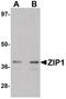 Solute Carrier Family 39 Member 1 antibody, PA5-21066, Invitrogen Antibodies, Western Blot image 