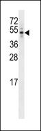 CEP44 antibody, LS-B12651, Lifespan Biosciences, Western Blot image 