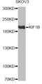 Kinesin Family Member 1B antibody, STJ28721, St John