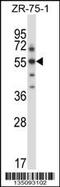 Serum/Glucocorticoid Regulated Kinase Family Member 3 antibody, MBS9214321, MyBioSource, Western Blot image 