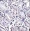 Forkhead Box P4 antibody, LS-C166244, Lifespan Biosciences, Immunohistochemistry paraffin image 