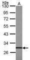 ZFP36 Ring Finger Protein Like 1 antibody, PA5-27445, Invitrogen Antibodies, Western Blot image 