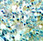 SRC Proto-Oncogene, Non-Receptor Tyrosine Kinase antibody, AP0452, ABclonal Technology, Immunohistochemistry paraffin image 