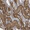 Cell Death Inducing DFFA Like Effector C antibody, NBP1-84470, Novus Biologicals, Immunohistochemistry paraffin image 