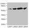 Neuronal acetylcholine receptor subunit alpha-6 antibody, LS-C675533, Lifespan Biosciences, Western Blot image 