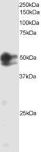 SMAD2 antibody, 45-147, ProSci, Western Blot image 