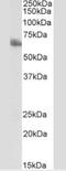 ANTXR Cell Adhesion Molecule 1 antibody, NBP2-33232, Novus Biologicals, Western Blot image 