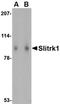 SLIT And NTRK Like Family Member 1 antibody, orb74934, Biorbyt, Western Blot image 