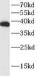 TATA-box-binding protein antibody, FNab08527, FineTest, Western Blot image 