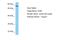 Complement Factor B antibody, A30047, Boster Biological Technology, Western Blot image 