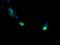 VPS28 Subunit Of ESCRT-I antibody, NBP2-45412, Novus Biologicals, Immunofluorescence image 