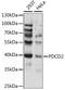 Programmed cell death protein 2 antibody, LS-C750270, Lifespan Biosciences, Western Blot image 