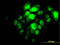 Interferon Regulatory Factor 5 antibody, LS-C133276, Lifespan Biosciences, Immunofluorescence image 