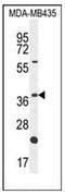 Olfactory Receptor Family 6 Subfamily V Member 1 antibody, AP53100PU-N, Origene, Western Blot image 