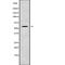 Ribosomal Protein S6 Kinase Like 1 antibody, abx218384, Abbexa, Western Blot image 