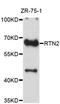 Reticulon 2 antibody, STJ26545, St John