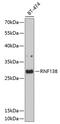 Ring Finger Protein 138 antibody, 13-567, ProSci, Western Blot image 