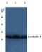 Cerebellin 4 Precursor antibody, PA5-36472, Invitrogen Antibodies, Western Blot image 