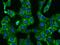 Poly(A) Binding Protein Cytoplasmic 4 antibody, GTX02196, GeneTex, Immunofluorescence image 