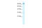 Aryl Hydrocarbon Receptor antibody, 27-527, ProSci, Western Blot image 