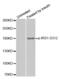 Insulin Receptor Substrate 1 antibody, abx000233, Abbexa, Western Blot image 