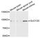 Guanylate Cyclase 2D, Retinal antibody, abx002605, Abbexa, Western Blot image 