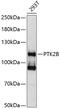 Protein-tyrosine kinase 2-beta antibody, 13-022, ProSci, Western Blot image 