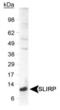 SRA Stem-Loop Interacting RNA Binding Protein antibody, PA1-46148, Invitrogen Antibodies, Western Blot image 