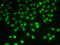 Histone Deacetylase 5 antibody, LS-C746747, Lifespan Biosciences, Immunofluorescence image 