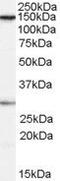 SPT16 Homolog, Facilitates Chromatin Remodeling Subunit antibody, PA5-18443, Invitrogen Antibodies, Western Blot image 