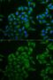 CD247 Molecule antibody, GTX53919, GeneTex, Immunofluorescence image 