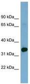 Homeobox D12 antibody, TA344485, Origene, Western Blot image 