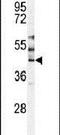 Serine/Threonine Kinase 24 antibody, PA5-15112, Invitrogen Antibodies, Western Blot image 