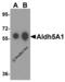 Aldehyde Dehydrogenase 5 Family Member A1 antibody, 4807, ProSci, Western Blot image 