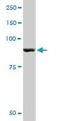 Glycogen Phosphorylase, Muscle Associated antibody, orb95239, Biorbyt, Western Blot image 