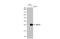 RAB7A antibody, GTX132548, GeneTex, Western Blot image 