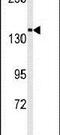 Transient Receptor Potential Cation Channel Subfamily M Member 7 antibody, PA5-15301, Invitrogen Antibodies, Western Blot image 