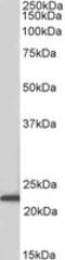 Achaete-Scute Family BHLH Transcription Factor 3 antibody, GTX01091, GeneTex, Western Blot image 