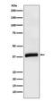 Apolipoprotein L1 antibody, M01841-1, Boster Biological Technology, Western Blot image 