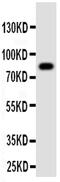 Proprotein Convertase Subtilisin/Kexin Type 4 antibody, PA5-79788, Invitrogen Antibodies, Western Blot image 