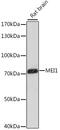 Meiotic Double-Stranded Break Formation Protein 1 antibody, 16-476, ProSci, Western Blot image 