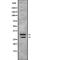 Msh Homeobox 1 antibody, PA5-67993, Invitrogen Antibodies, Western Blot image 