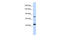 LDL Receptor Related Protein 8 antibody, ARP44723_P050, Aviva Systems Biology, Western Blot image 