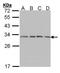 Proteasome Subunit Alpha 7 antibody, GTX101745, GeneTex, Western Blot image 