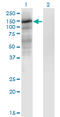 HIF-2-alpha antibody, LS-C197138, Lifespan Biosciences, Western Blot image 