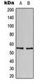 HMG-Box Transcription Factor 1 antibody, GTX55229, GeneTex, Western Blot image 