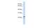 Receptor Accessory Protein 1 antibody, GTX45998, GeneTex, Western Blot image 