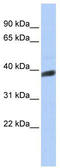 Immediate-early protein CL-6 antibody, TA345658, Origene, Western Blot image 